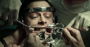 A Cure for Wellness Movie photos